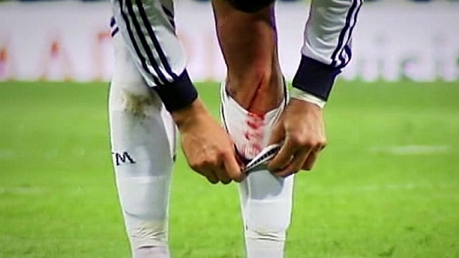 Cristiano Ronaldo sufrió un corte en una pierna, pero podrá jugar en la Champions