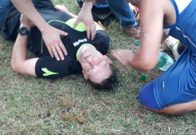 Arbitro sufrió brutal agresión por parte de un jugador en Argentina