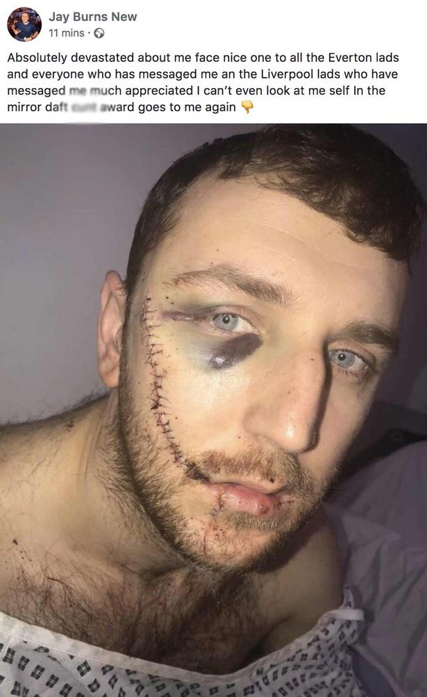 Hincha de Everton inglés acuchillado: Ya no puedo ni mirarme al espejo
