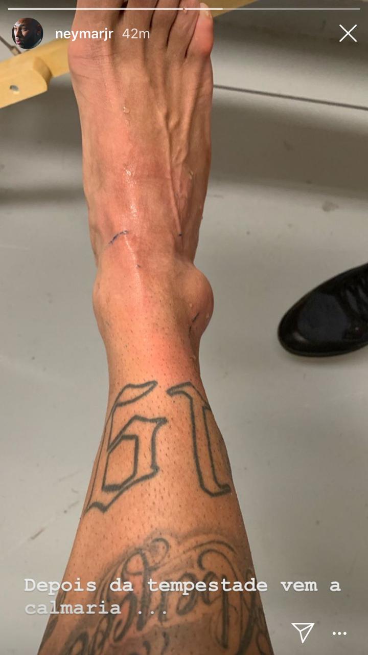 Neymar mostró el estado de su tobillo y envió un mensaje