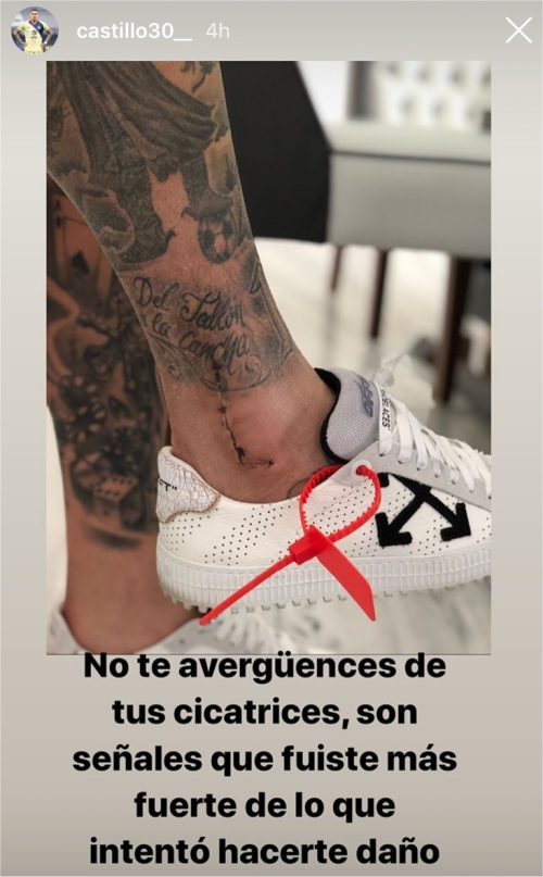 Nicolás Castillo exhibió cicatriz que le dejó operación en la pierna derecha