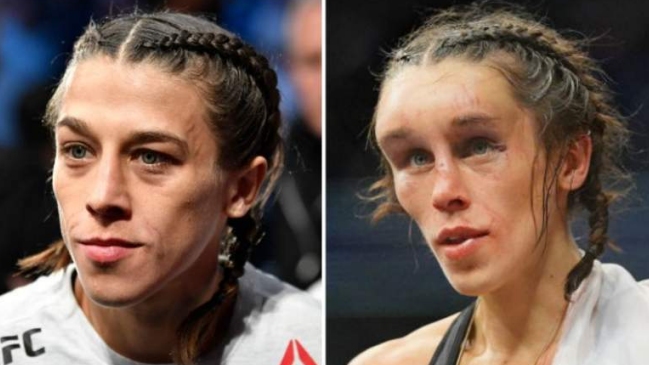 Peleadora UFC recordó la vez que le desfiguraron el rostro en un combate: Parecía un zombie