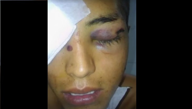 Policías fueron brutalmente agredidos por intentar detener partido de fútbol en zona con cuarentena