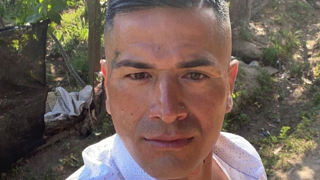 “Kike” Acuña tras tratamiento con botox: Me dicen que me veo más joven y bonito