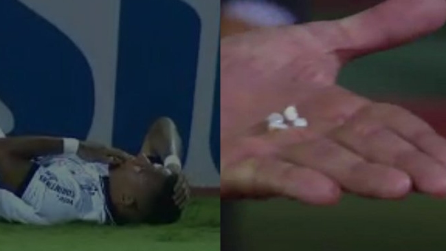 Rómulo Otero perdió parte de su dentadura por fuerte choque en partido de Corinthians