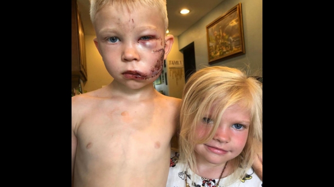 Consejo Mundial de Boxeo creó división en honor a niño que salvó a su hermana de ataque de un perro