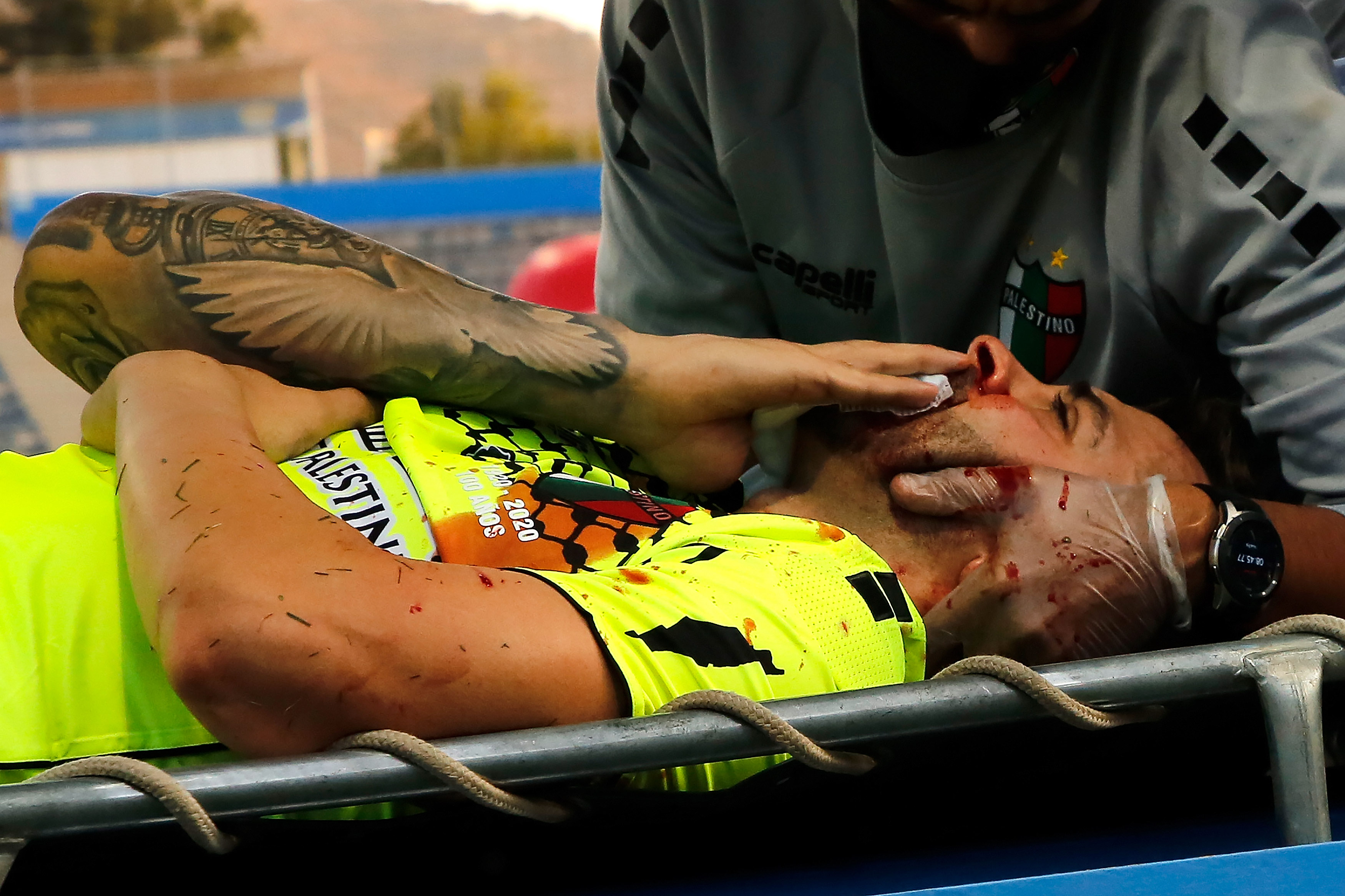 El terrible choque del arquero de Palestino Federico Lanzillota con la rodilla de Zampedri