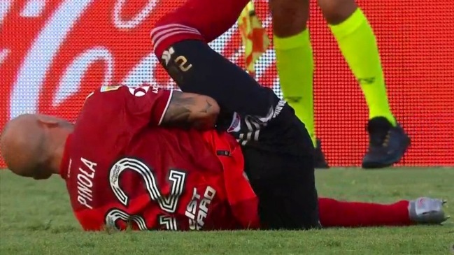 La escalofriante fractura de brazo de Javier Pinola en duelo de River Plate frente a Platense
