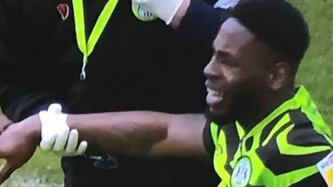 Futbolista sufrió horrorosa fractura de mano en Inglaterra
