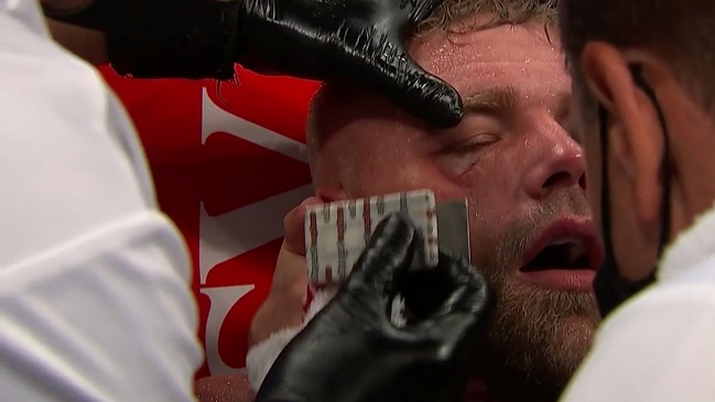 Billy Joe Saunders será operado de fractura en el rostro por brutales golpes de “Canelo” Alvarez