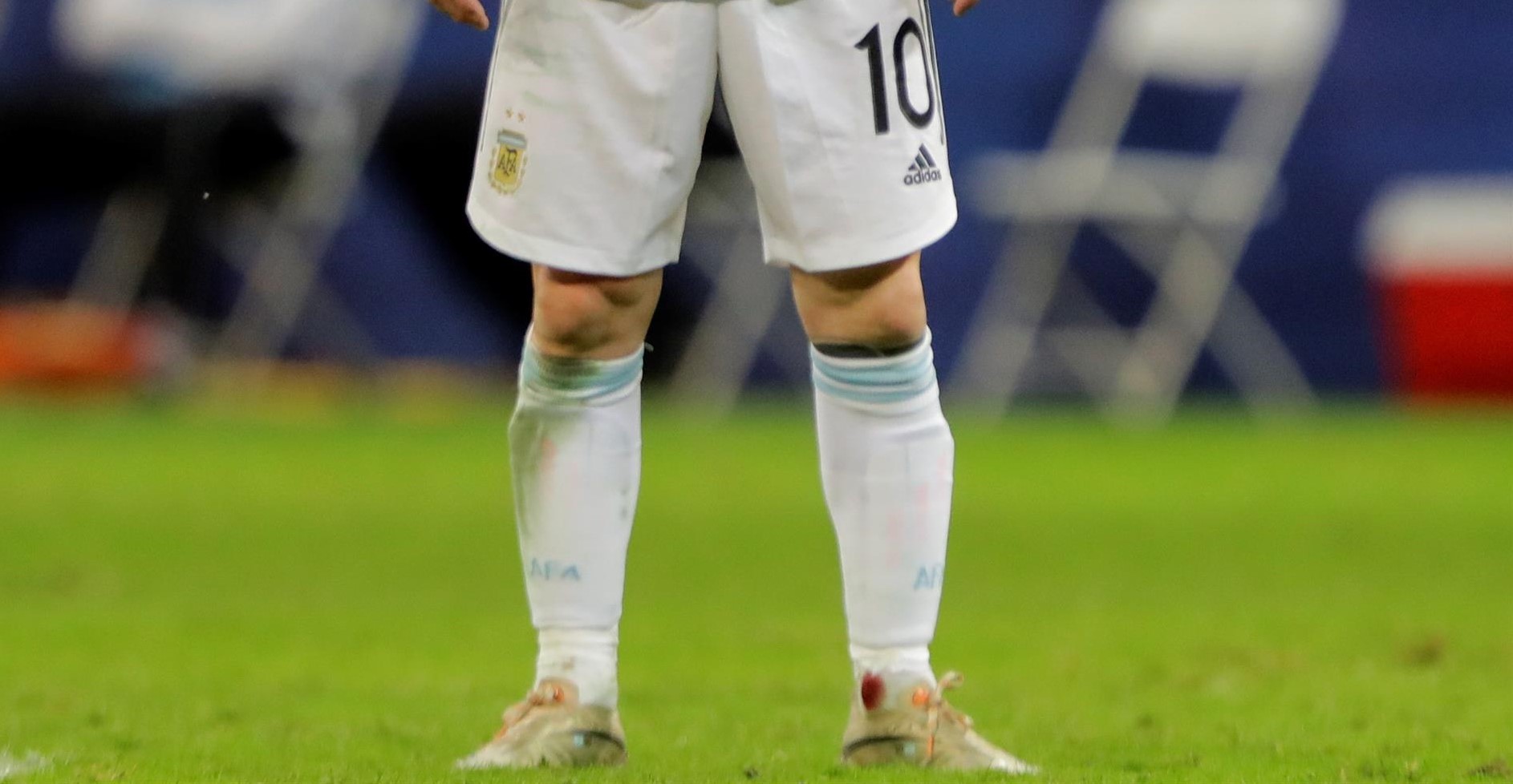 Messi en modo Maradona: Jugó con el tobillo ensangrentado ante Colombia