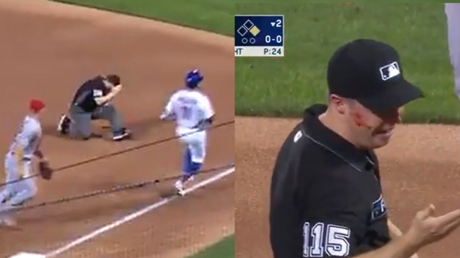 Umpire sufrió herida por brutal pelotazo en partido de beisbol