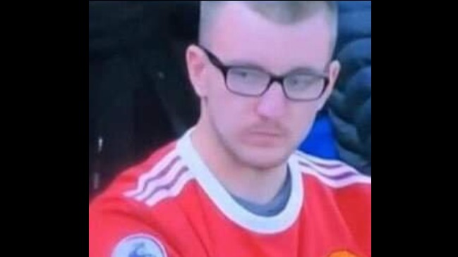 Hincha demandó a Manchester United culpándolo por su calvicie