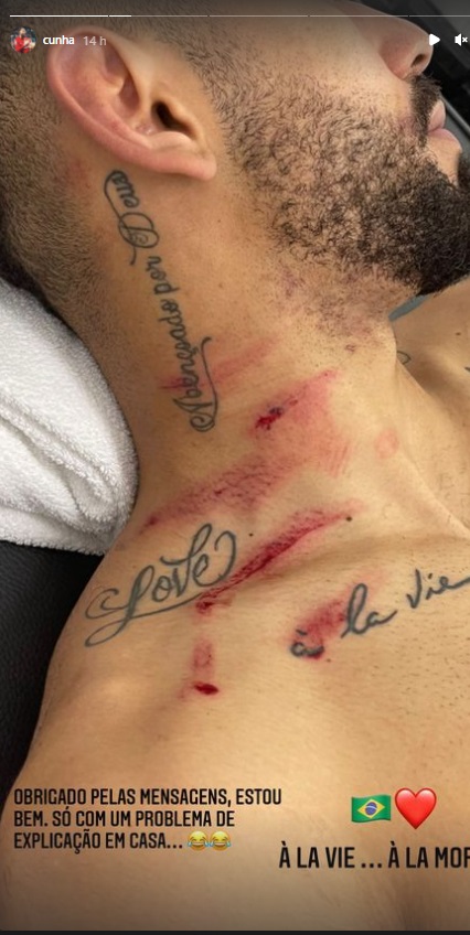 Así quedó el cuello del brasileño Cunha tras brutal patada de Alexander Domínguez