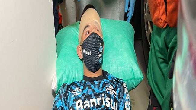 ¡Terrible! Clásico gaúcho fue suspendido por brutal ataque a bus de Gremio