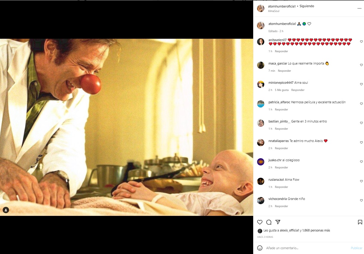 Alexis Sánchez usó a “Patch” Adams y Michael Jackson para pedir paz en el mundo