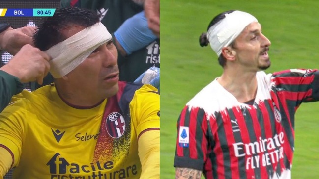 Terminaron ensangrentados y con un parche: El brutal choque entre Gary Medel e Ibrahimovic