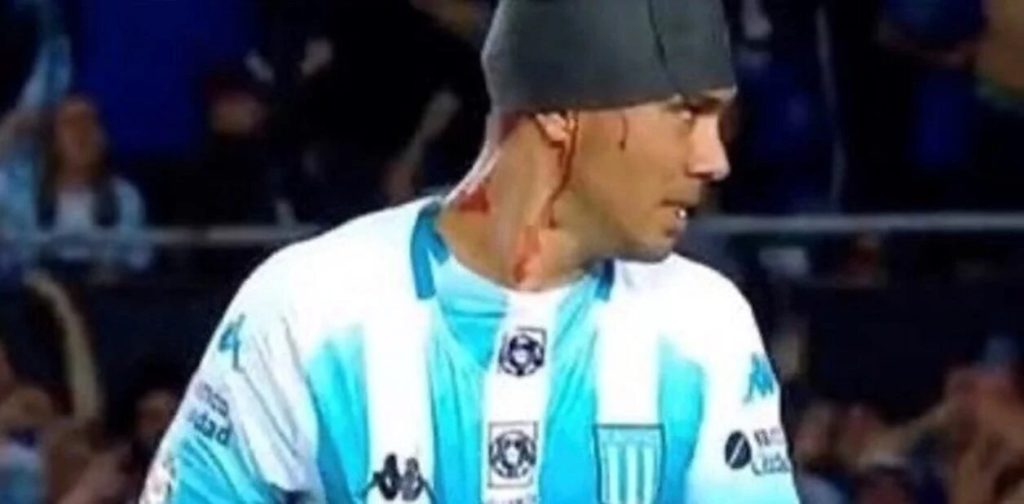 La lesión que padece Nery Domínguez en medio de sus negociaciones con la U