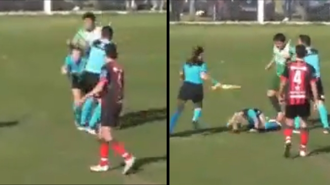 Arbitra que sufrió cobarde agresión: Perdí el conocimiento y estuve con vómitos