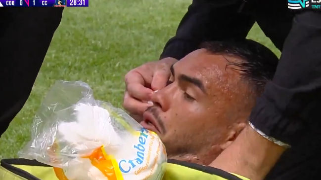 Gabriel Suazo sufrió un fuerte golpe en su rostro en el duelo con Coquimbo Unido