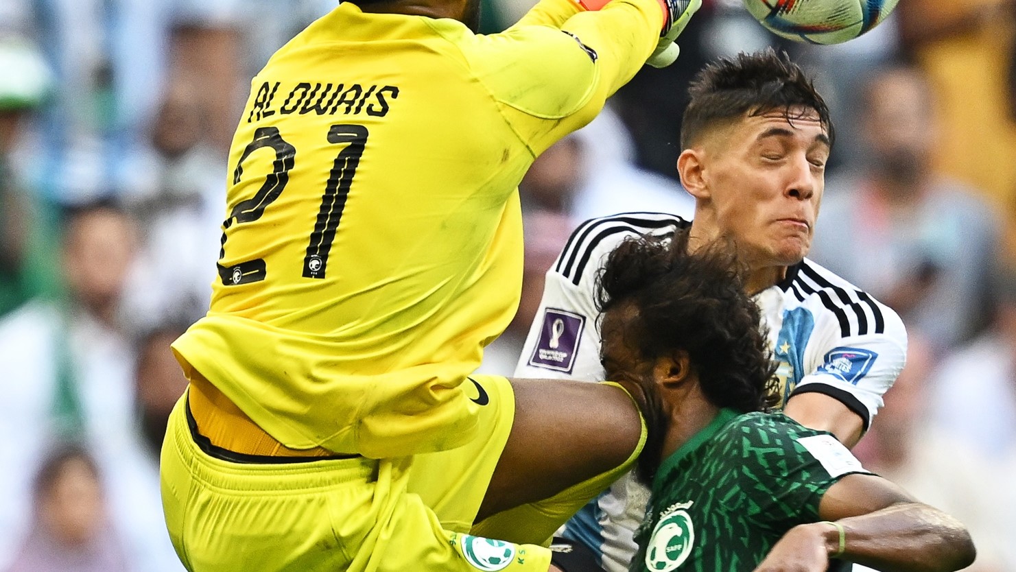 Yasser Al-Shahrani fue operado del páncreas y necesitará varias cirugías faciales