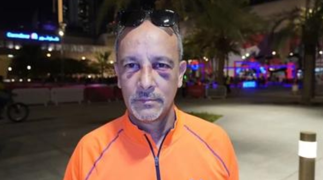 Hincha argentino relató brutal golpiza que sufrió de manos de hinchas mexicanos en Qatar