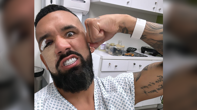“Empezamos a recuperar”: Ronnie Fernández inició el postoperatorio por su fractura facial