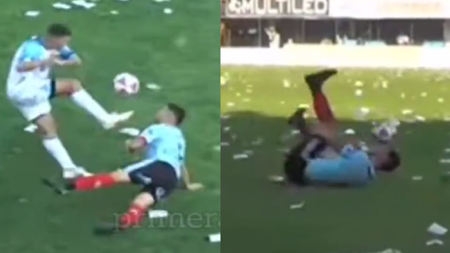 Claudio Bieler provocó fractura nasal a un rival con tremenda patada