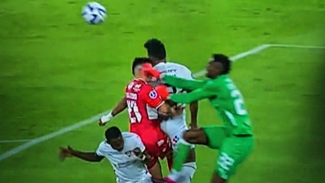 Así quedó el rostro de Raimundo Rebolledo tras el brutal golpe que recibió de Alexander Domínguez