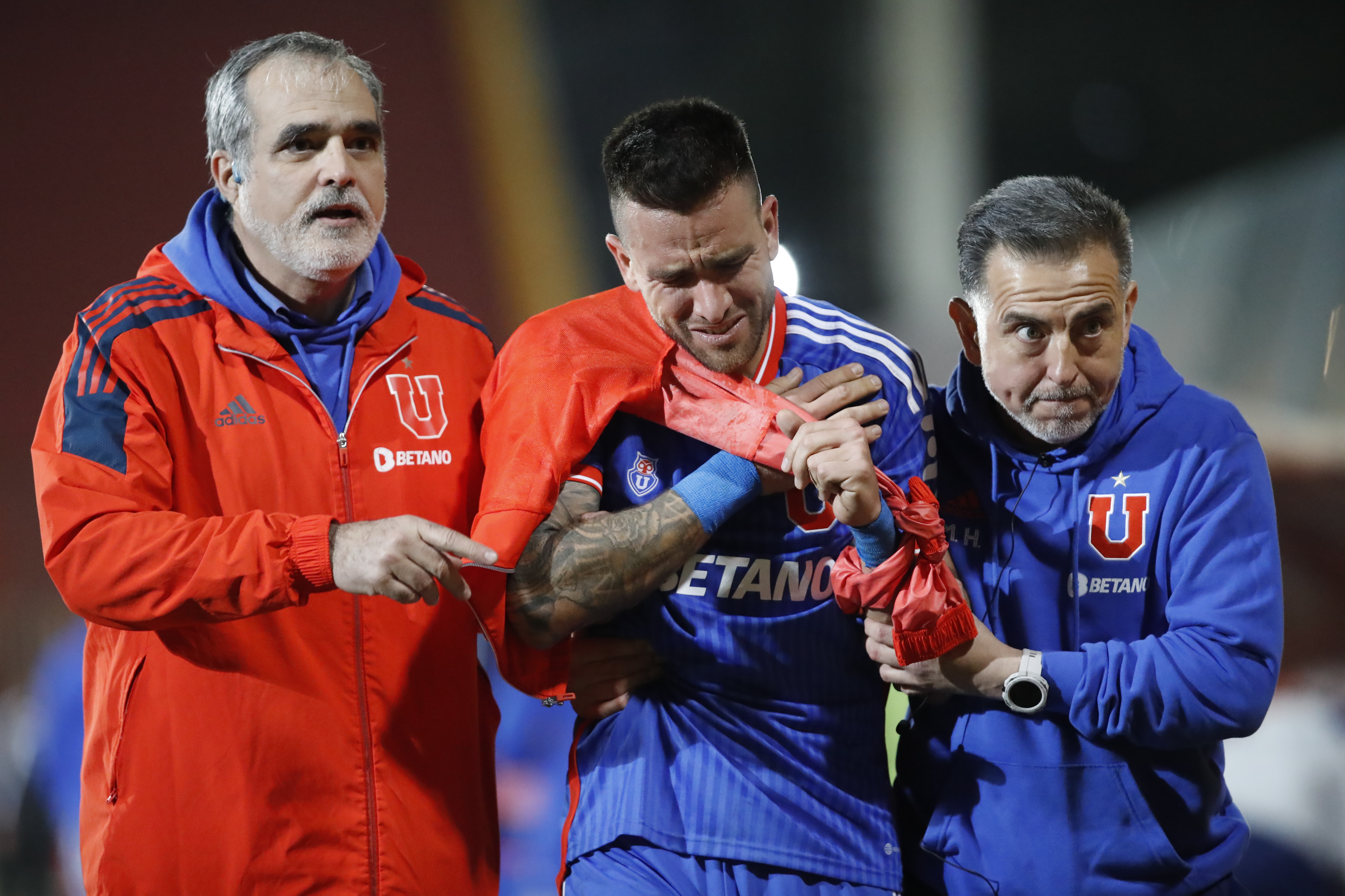 La dura lesión en el hombro que sufrió Matías Zaldivia ante Curicó Unido