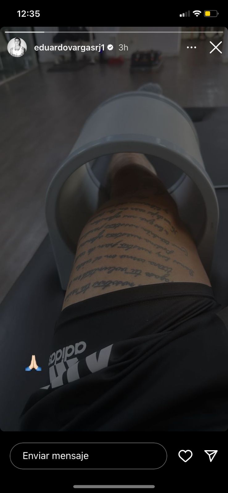 Eduardo Vargas trabaja en la recuperación de su esguince de rodilla