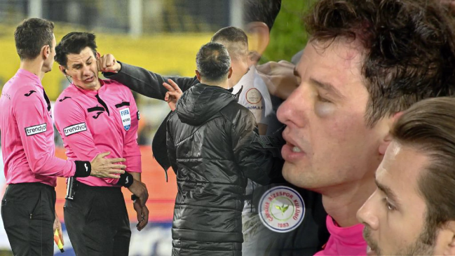 Arbitro turco dejó el hospital tras ser tratado por golpes recibidos