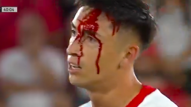 Echeverría quedó con el rostro ensangrentado tras recibir una patada en Argentina