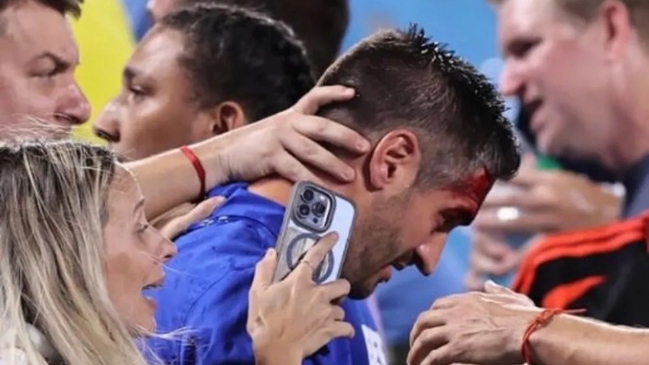 El uruguayo Rodrigo Bentancur sin querer lesionó al preparador físico de su selección