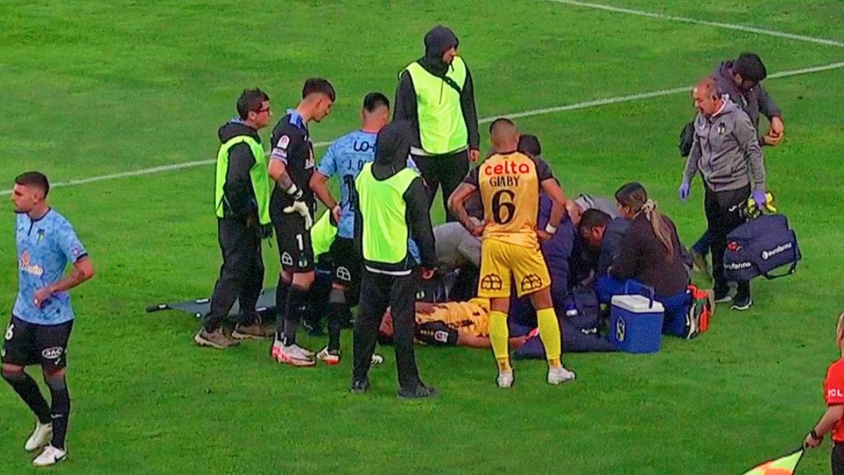 Dramático momento: Jugador de Coquimbo sufrió una terrible lesión ante O’Higgins
