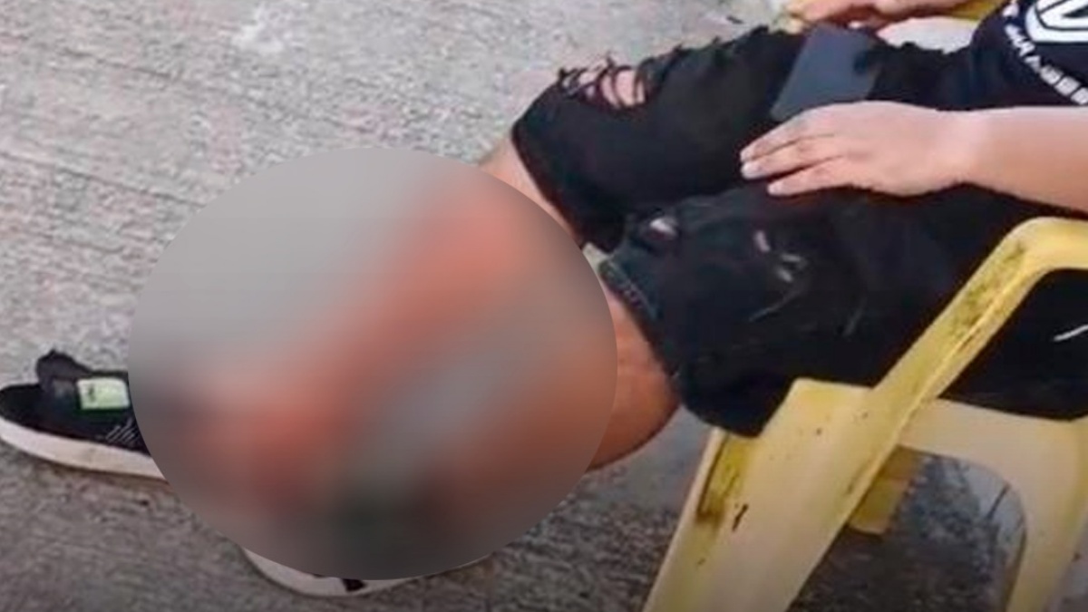 Hincha de Colo Colo fue baleado en un asalto en Fortaleza