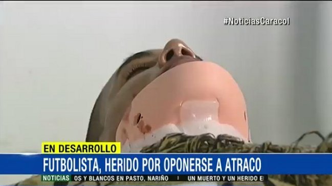 Futbolista colombiano recibió disparo en el cuello y quedó parapléjico