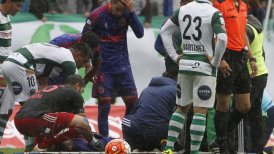 Jonathan Zacaría sufrió fractura de tibia y peroné en duelo entre U. de Chile y Deportes Temuco