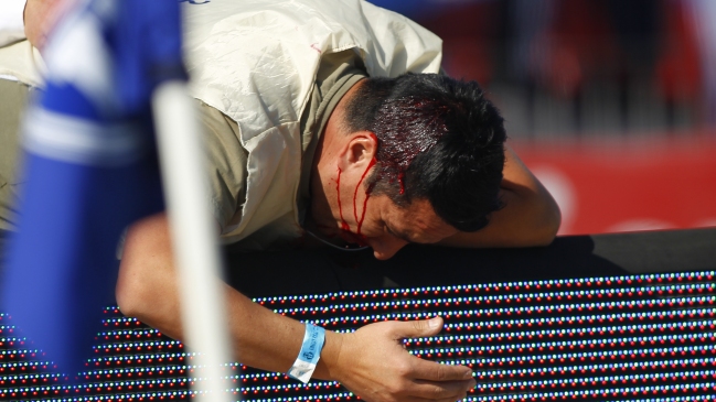Fotógrafo oficial de Colo Colo sufrió herida en su cabeza por un proyectil en el Superclásico
