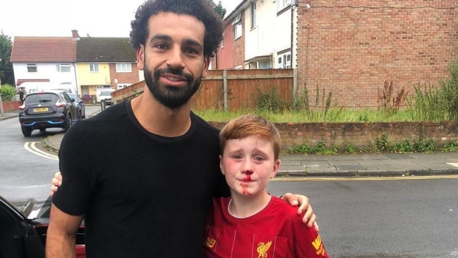 El noble gesto de Mohamed Salah con niño que se fracturó la nariz siguiéndolo