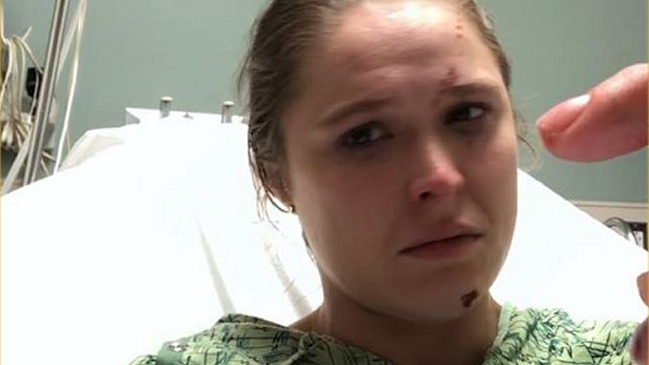 Ronda Rousey sufrió impactante accidente durante rodaje de una serie