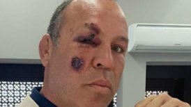 Ex estrella de la UFC Wanderlei Silva otra vez sufrió accidente de tránsito: Pude haber muerto