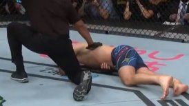 Chris Weidman sufrió horrorosa fractura en evento de la UFC