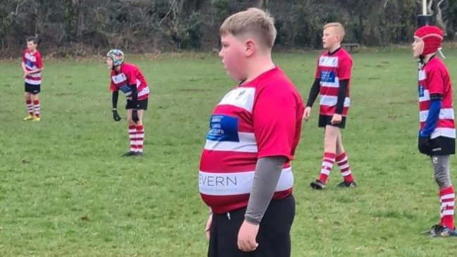 Estrellas del rugby salieron en apoyo de niño criticado por su aspecto físico