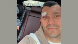 Así está la herida de Gary Medel a días de su cabezazo con Zlatan