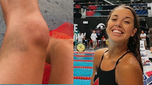 Nadadora canadiense denunció que fue drogada en los Mundiales de Budapest