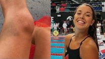 A Canadian swimmer has condemned drugging at the World Championships in Budapest.