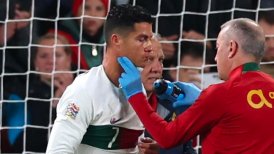 Cristiano Ronaldo sufrió durísimo golpe en la nariz ante República Checa