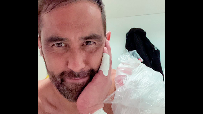 Claudio Bravo terminó adolorido y con una bolsa de hielo tras empate de Betis