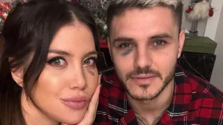 Eso es amor: Wanda Nara encontró la solución para el moretón de Mauro Icardi